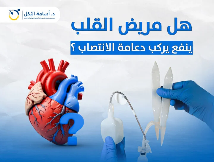 هل مريض القلب ينفع يركب دعامة الانتصاب؟