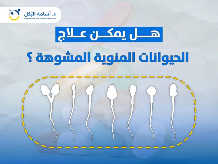 هل تشوه الحيوانات المنوية سبب الإجهاض المتكرر؟