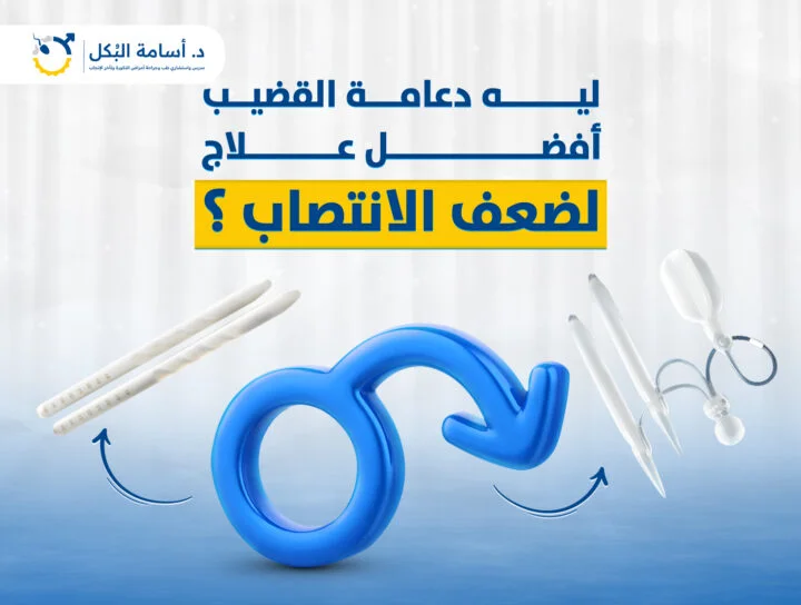 دعامة القضيب: خيار متقدم لعلاج ضعف الانتصاب