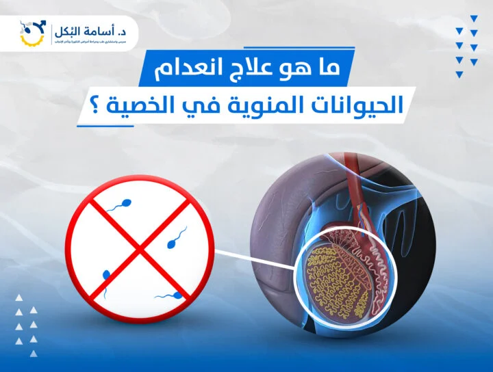 ما هي شروط إجراء تحليل السائل المنوي للرجال؟
